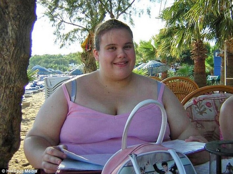 Sức khỏe - Giảm 140kg mỡ thừa, cô gái phải hối hận cả đời