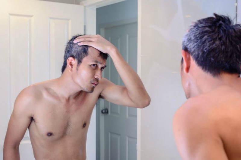 nguoi tre bi toc bac anh 4