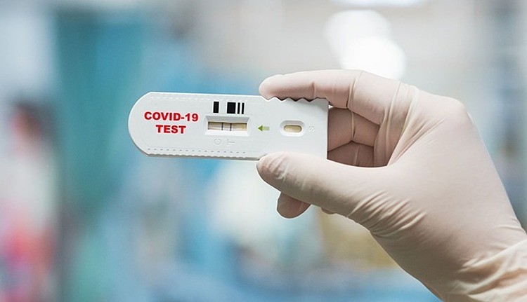 Bác sĩ Trương Hữu Khanh: Test nhanh Covid-19 thế nào để hiệu quả, ít tốn kém?
