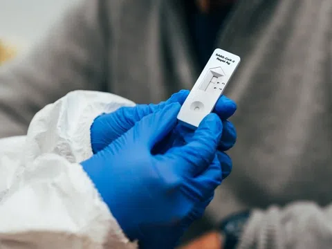 Vạch kit test Covid-19 lúc mờ lúc đậm có ý nghĩa gì?