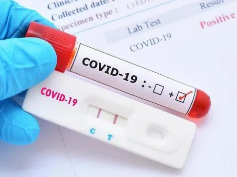 Bộ Y tế: Người chưa tiêm đủ liều vaccine COVID-19 ở vùng dịch về phải cách ly 14 ngày, xét nghiệm 3 lần