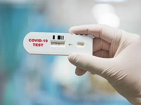 Bác sĩ Trương Hữu Khanh: Test nhanh Covid-19 thế nào để hiệu quả, ít tốn kém?